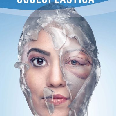 E-Book 3° Manual de Condutas - Urgências em Oculoplástica