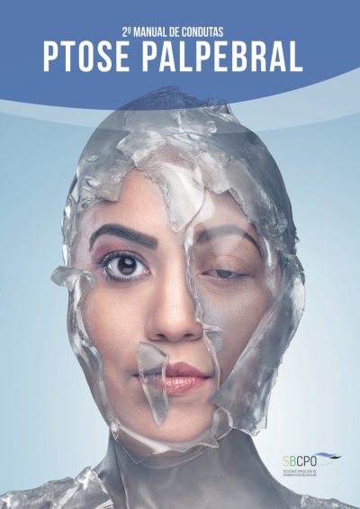 2º Manual de Condutas em Ptose Palpebral