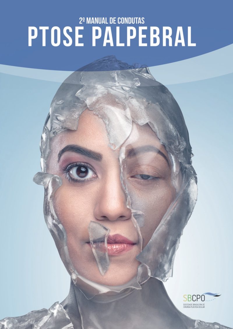 2º Manual de Condutas em Ptose Palpebral