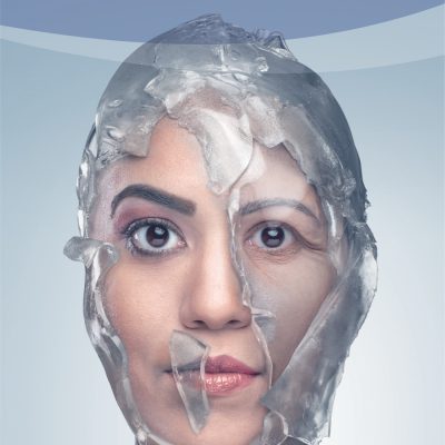 E-Book 1º Manual de Condutas em Blefaroplastia