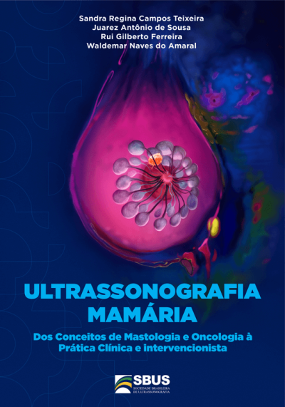 E-Book Ultrassonografia Mamária: Dos conceitos de Mastologia e Oncologia à Prática Clínica e Intervencionalista