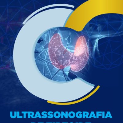Ultrassonografia de Tireoide