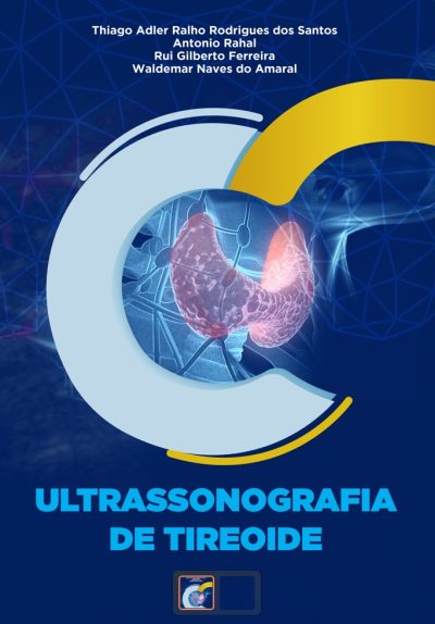 Ultrassonografia de Tireoide