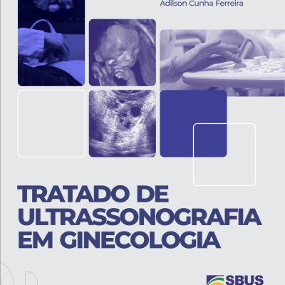 E-book Tratado de Ultrassonografia em Ginecologia