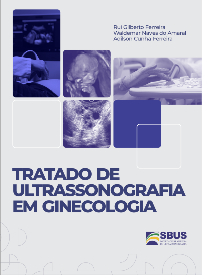 Tratado de Ultrassonografia em Ginecologia