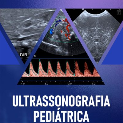 E-Book Ultrassonografia Pediátrica