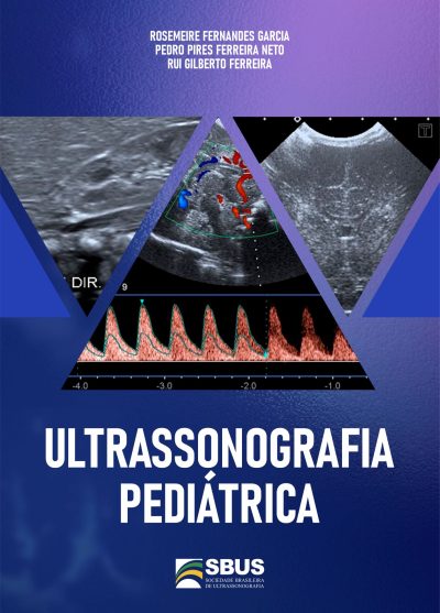 E-Book Ultrassonografia Pediátrica